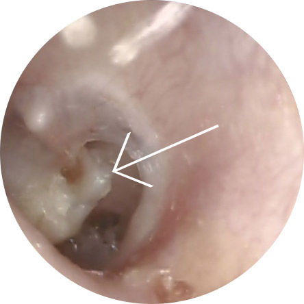 Ear Problems Ent Specialist Surgeon Adelaide Paul Varley Ent