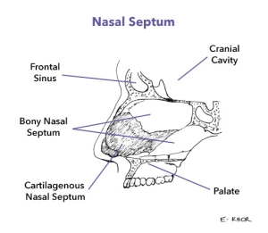 Septoplasty
